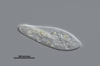 Paramecium caudatum x100